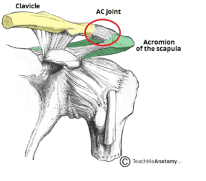 AC joint dislocation Rayleigh NC